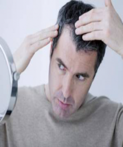 ریزش مو-