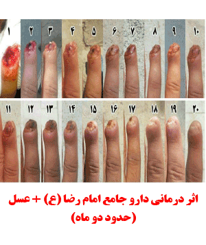 اثر درمانی دارو جامع امام رضا ع (طب اسلامی-آیت الله تبریزیان) عطاری مسلمین