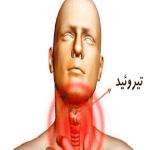 درمان تیروئید (طب اسلامی-آیت الله تبریزیان) عطاری مسلمین
