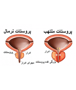 پروستات ملتهب (طب اسلامی-آیت الله تبریزیان) عطاری مسلمین
