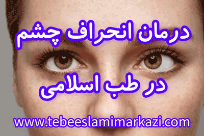 درمان انحراف چشم در طب اسلامی، درمان انحراف چشم بدون عمل جراحی، درمان انحراف چشم آیت الله تبریزیان، درمان انحراف چشم طب اسلامی مرکزی (عطاری مسلمین)