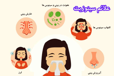 علائم سینوزیت