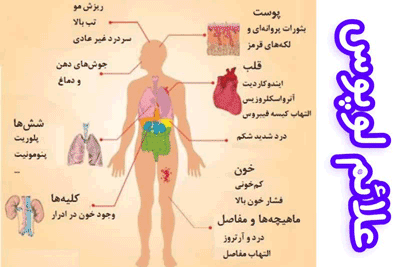 علائم لوپوس، درمان لوپوس در طب اسلامی، درمان لوپوس کاملا گیاهی