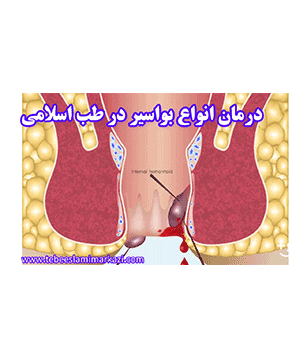 درمان هیموروئید در طب اسلامی