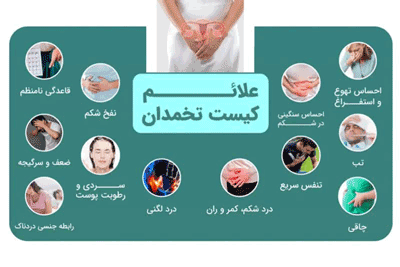 درمان خانگی کیست تخمدان طب اسلامی تبریزیان