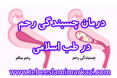 درمان قطعی چسبندگی رحم در طب اسلامی تبریزیان، درمان چسبندگی رحم کاملا گیاهی، درمان خانگی چسبندگی رحم در طب اسلامی، درمان چسبندگی رحم در طب اسلامی مرکزی(عطاری مسلمین)